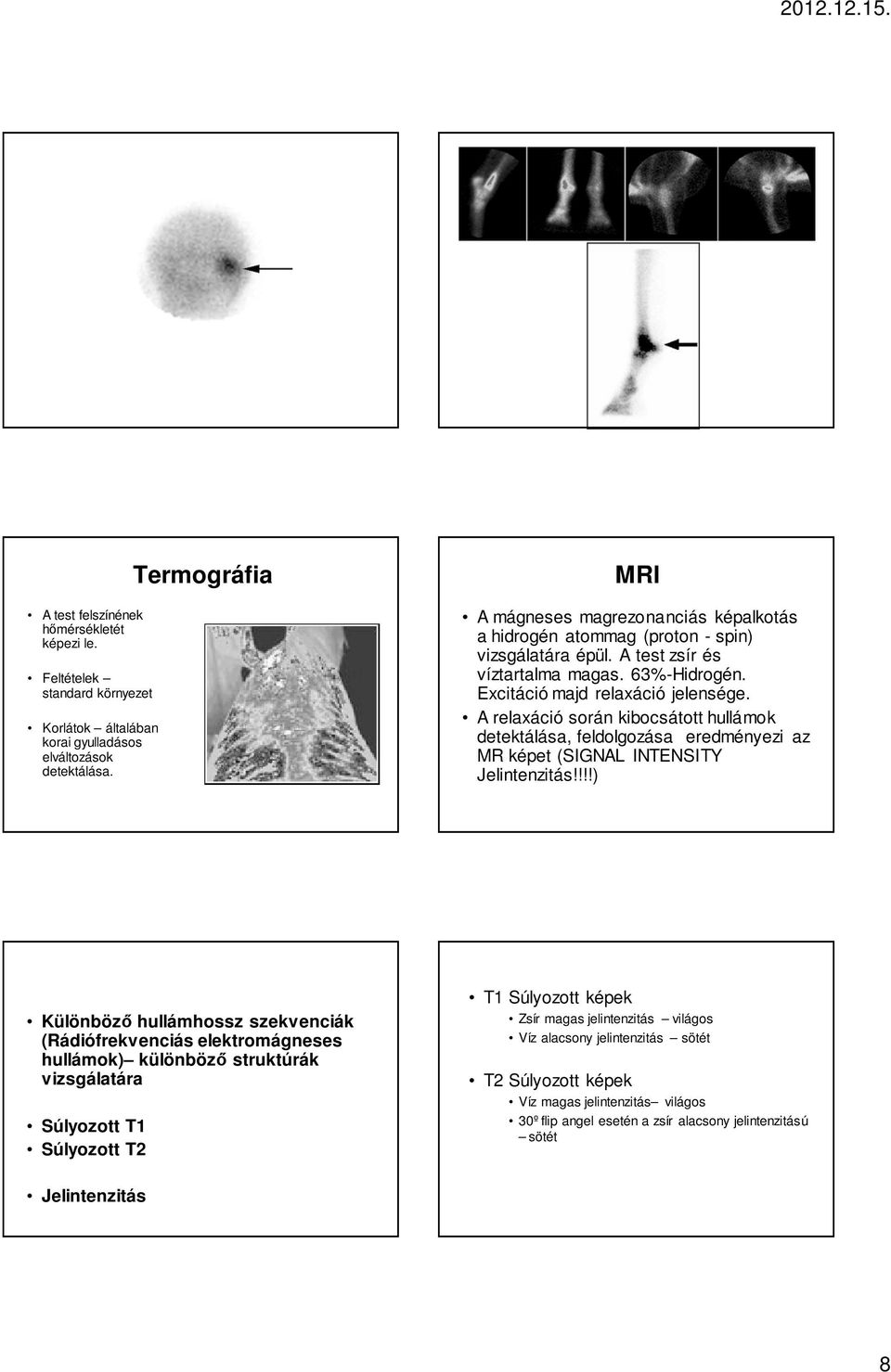 A relaxáció során kibocsátott hullámok detektálása, feldolgozása eredményezi az MR képet (SIGNAL INTENSITY Jelintenzitás!