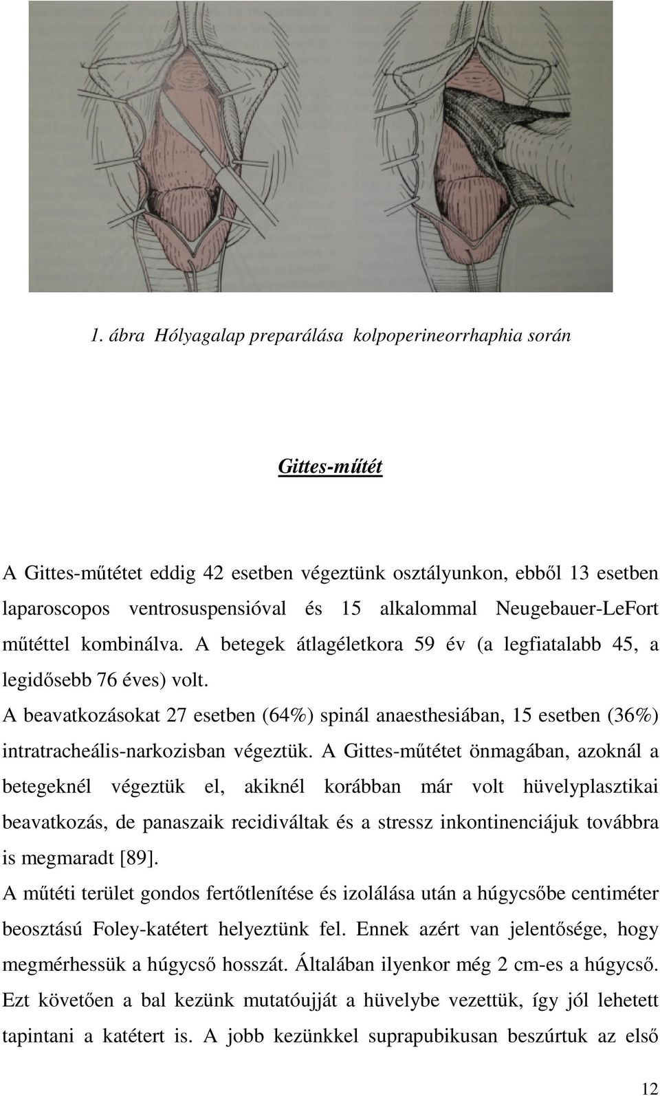 A beavatkozásokat 27 esetben (64%) spinál anaesthesiában, 15 esetben (36%) intratracheális-narkozisban végeztük.