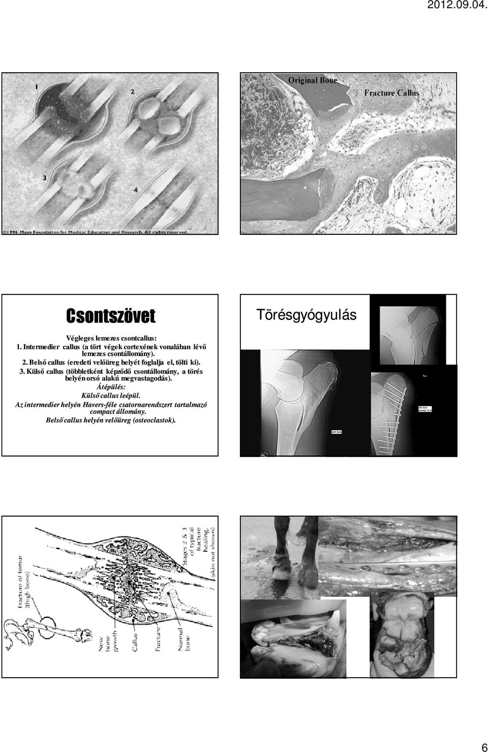 Belső callus (eredeti velőüreg helyét foglalja el, tölti ki). 3.