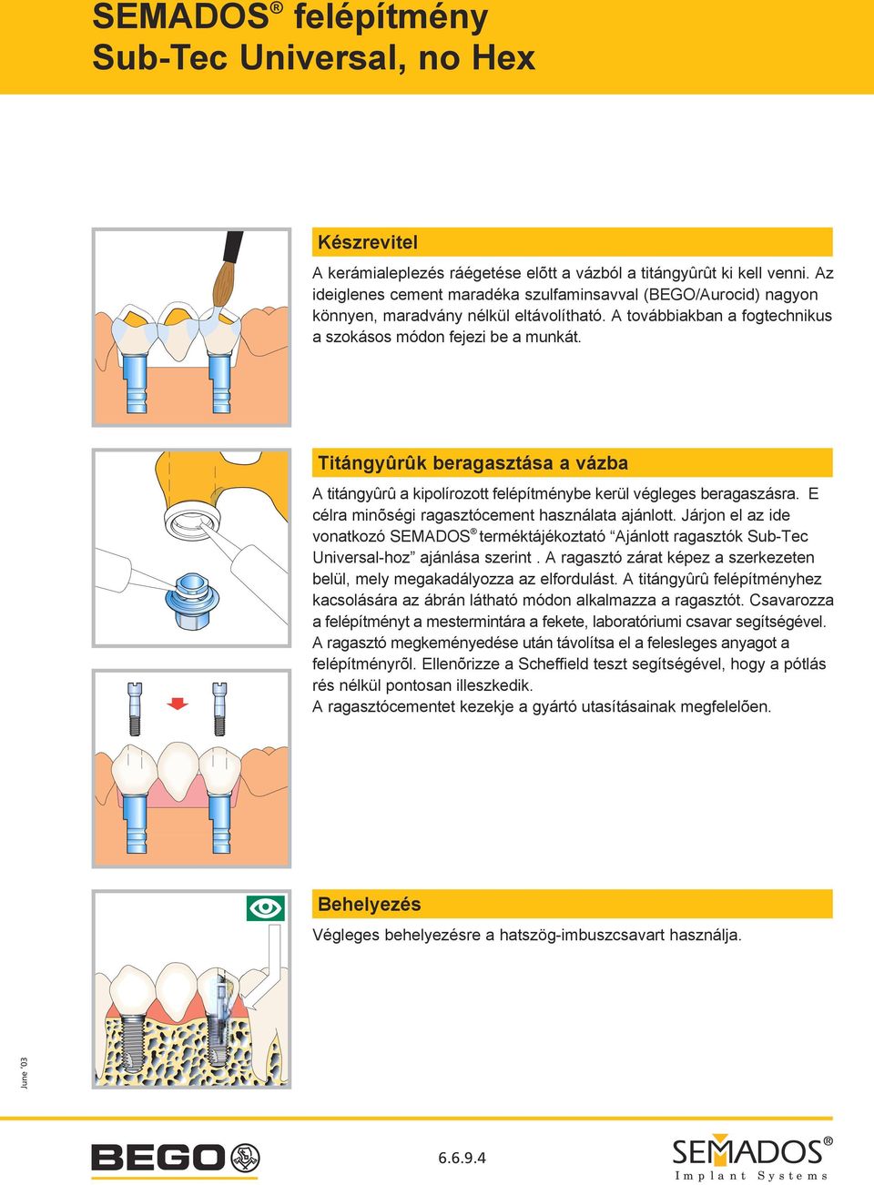 E célra minõségi ragasztócement használata ajánlott. Járjon el az ide vonatkozó SEMADOS terméktájékoztató Ajánlott ragasztók Sub-Tec Universal-hoz ajánlása szerint.