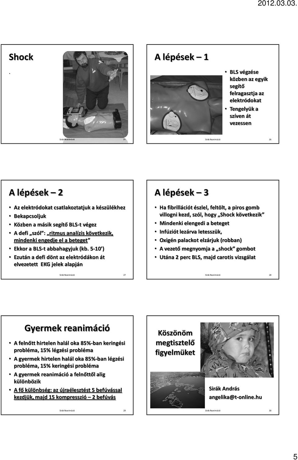 jelek alapján Ha fibrillációt észlel, feltölt, a piros gomb villogni kezd, szól, hogy Shock következik Mindenki elengedi a beteget Infúziót lezárva letesszük, Oxigén palackot elzárjuk (robban) A