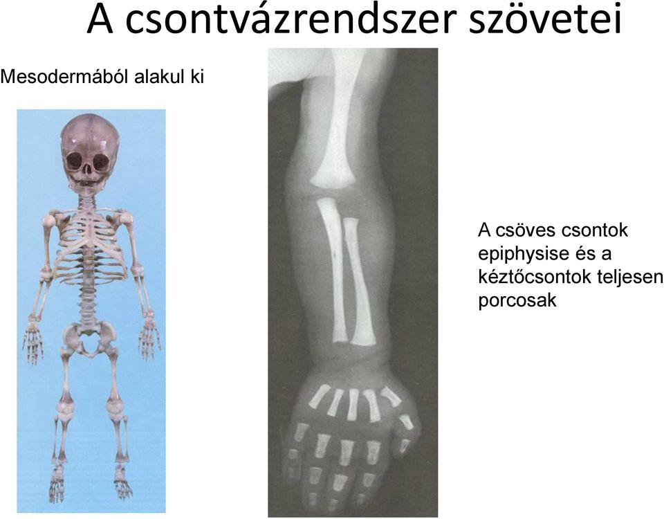 csöves csontok epiphysise és