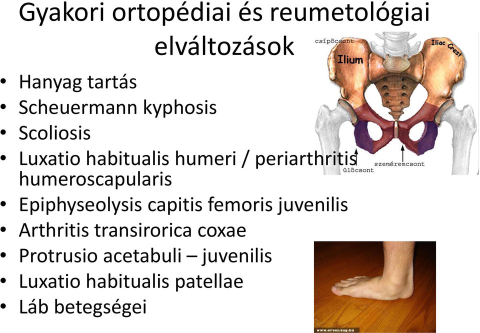 humeroscapularis Epiphyseolysis capitis femoris juvenilis Arthritis