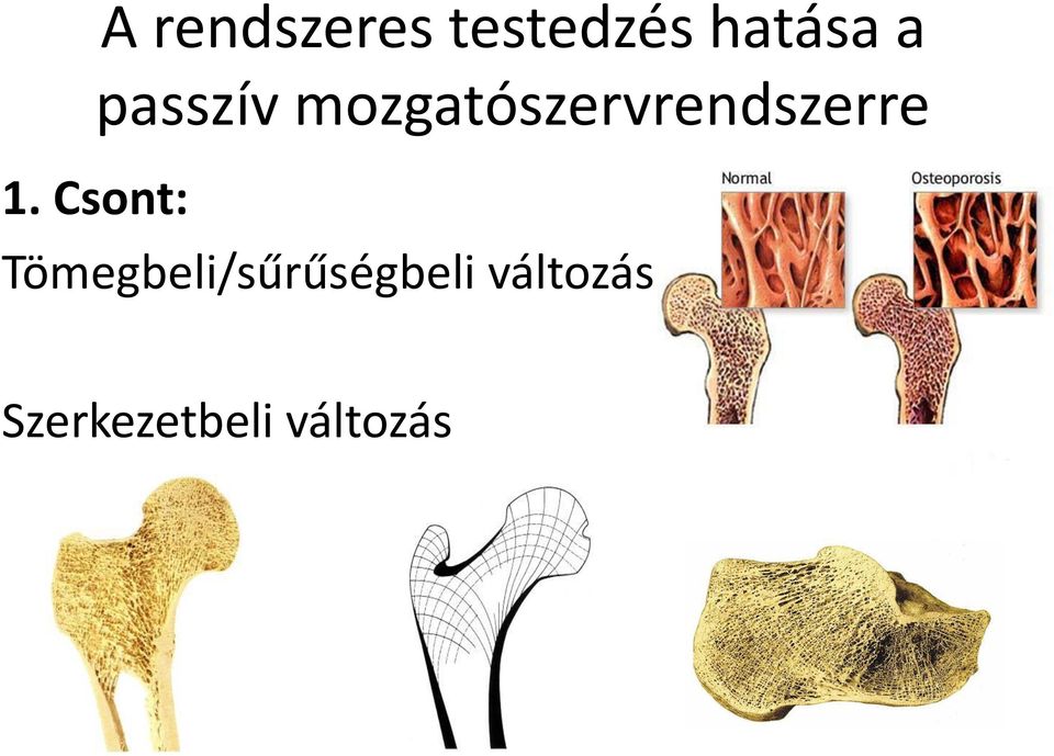 1. Csont: Tömegbeli/sűrűségbeli