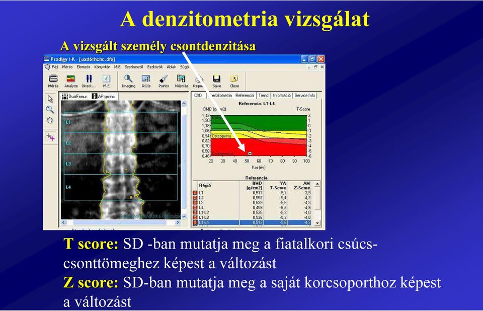 fiatalkori csúcscsonttömeghez képest a változást Z