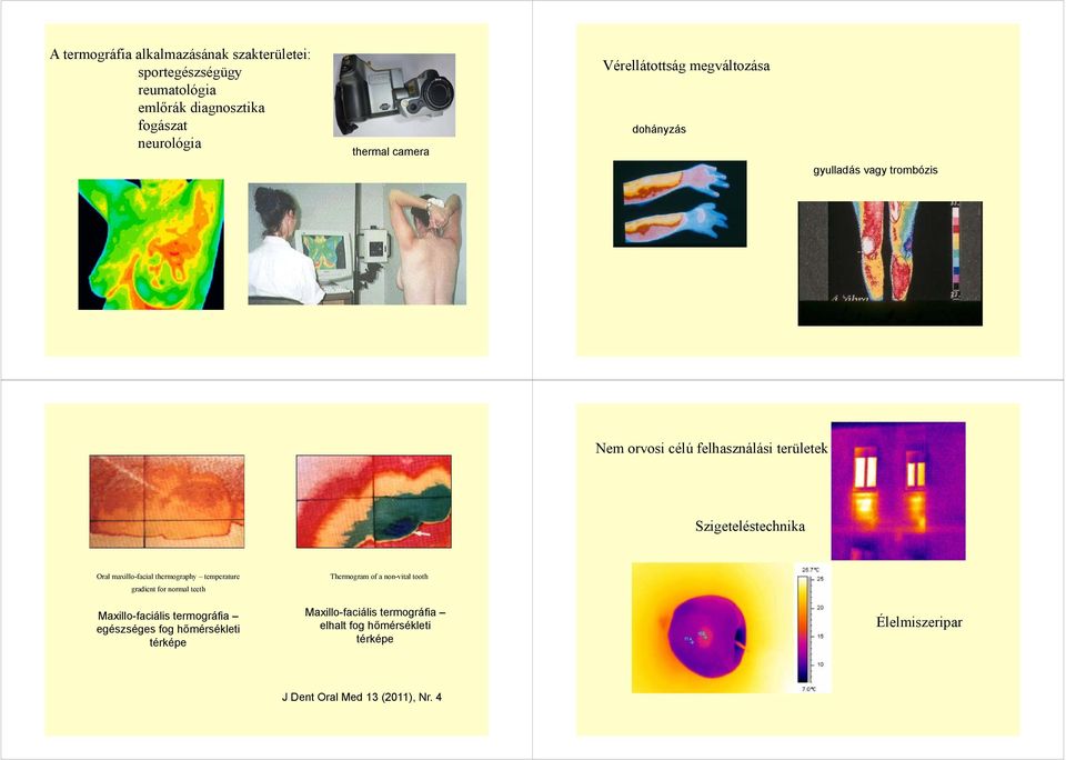 maxillo-facial thermography temperature gradient for normal teeth axillo-faciális termográfia egészséges fog hőmérsékleti térképe