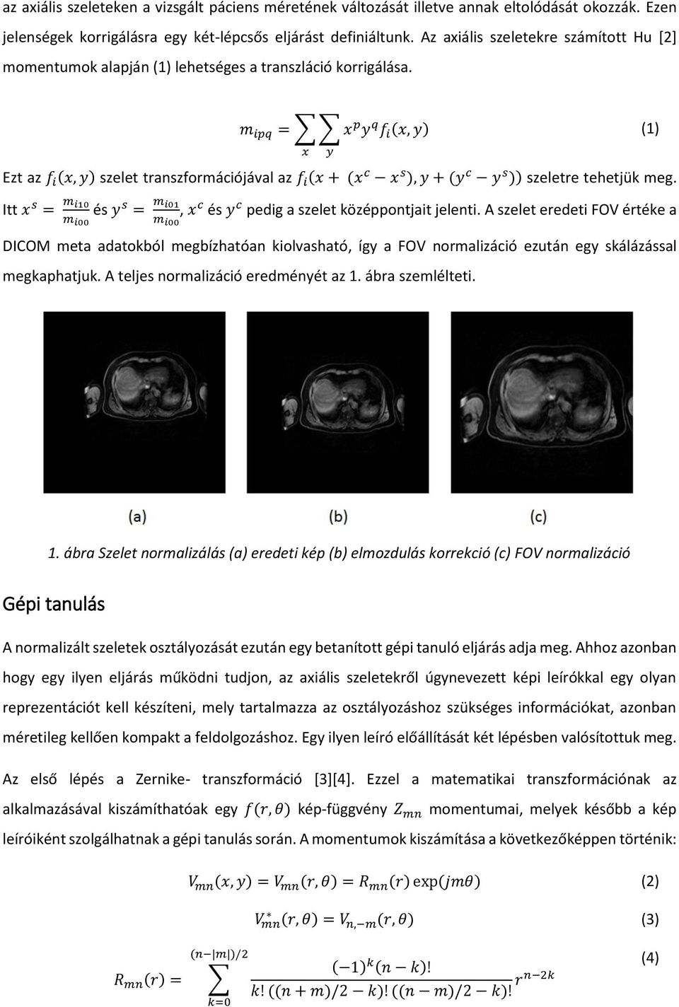 m ipq = x p y q f i (x, y) (1) x y Ezt az f i (x, y) szelet transzformációjával az f i (x + (x c x s ), y + (y c y s )) szeletre tehetjük meg.