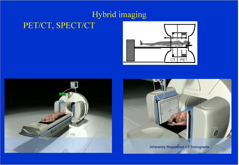 PET/CT,