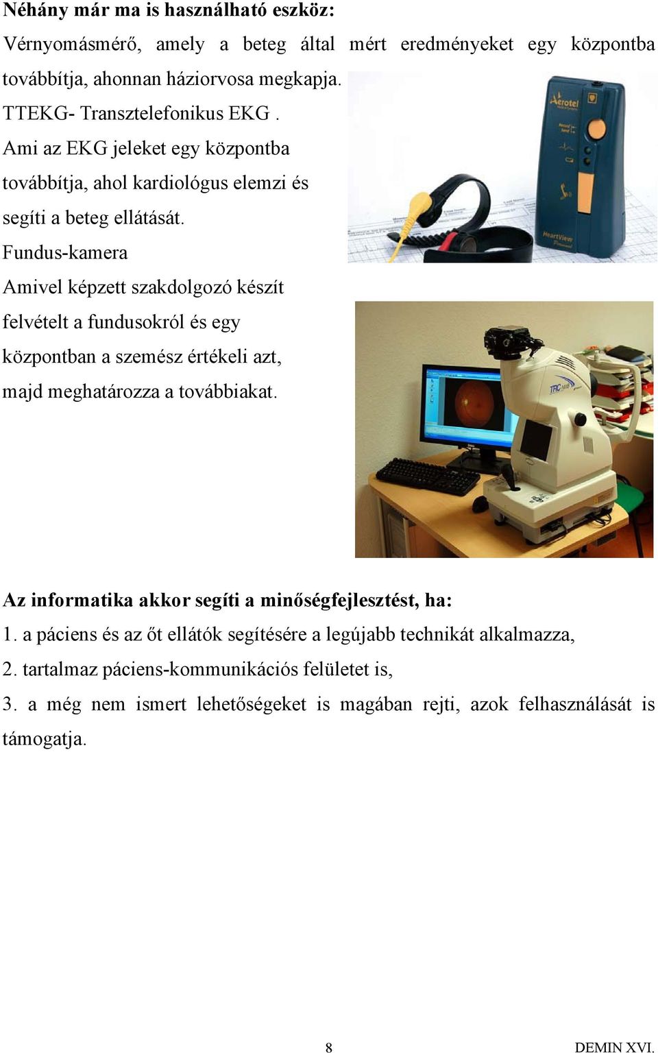 Fundus-kamera Amivel képzett szakdolgozó készít felvételt a fundusokról és egy központban a szemész értékeli azt, majd meghatározza a továbbiakat.