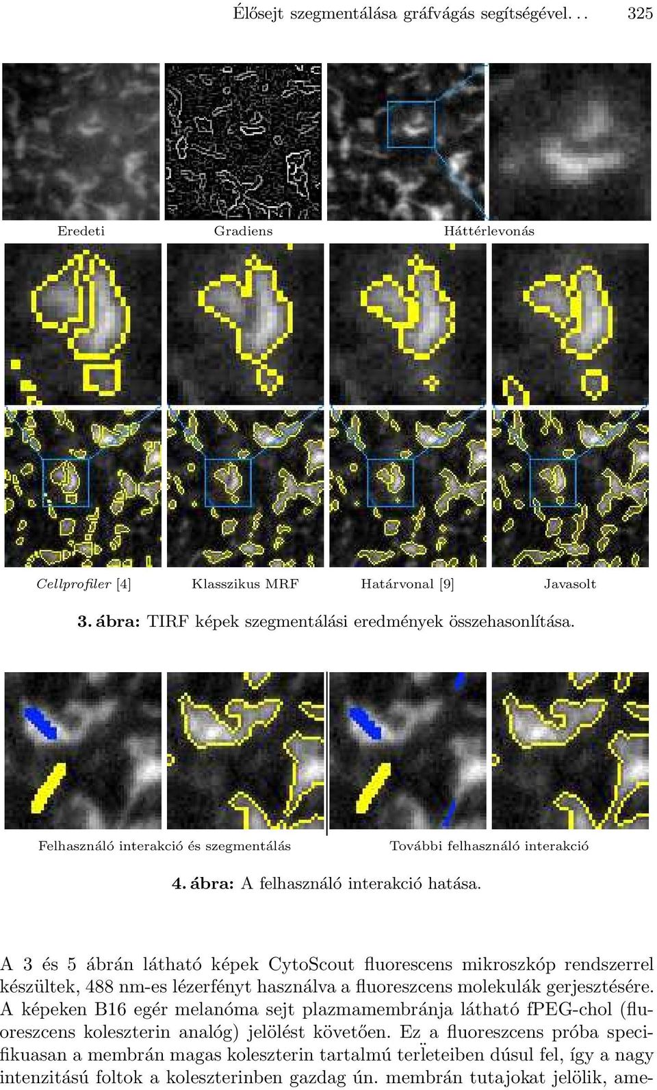 A 3 és 5 ábrán látható képek CytoScout fluorescens mikroszkóp rendszerrel készültek, 488 nm-es lézerfényt használva a fluoreszcens molekulák gerjesztésére.
