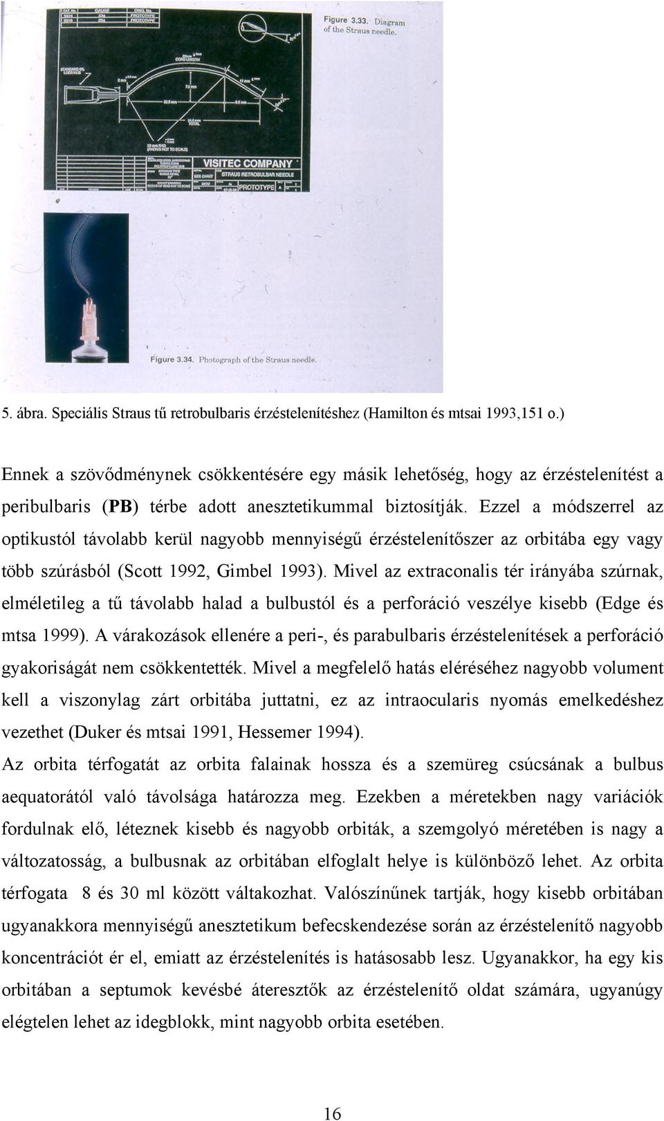 Ezzel a módszerrel az optikustól távolabb kerül nagyobb mennyiségű érzéstelenítőszer az orbitába egy vagy több szúrásból (Scott 1992, Gimbel 1993).