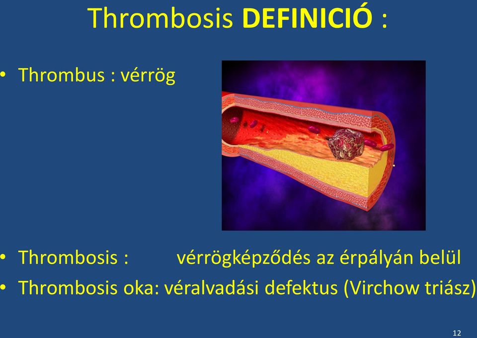 az érpályán belül Thrombosis oka: