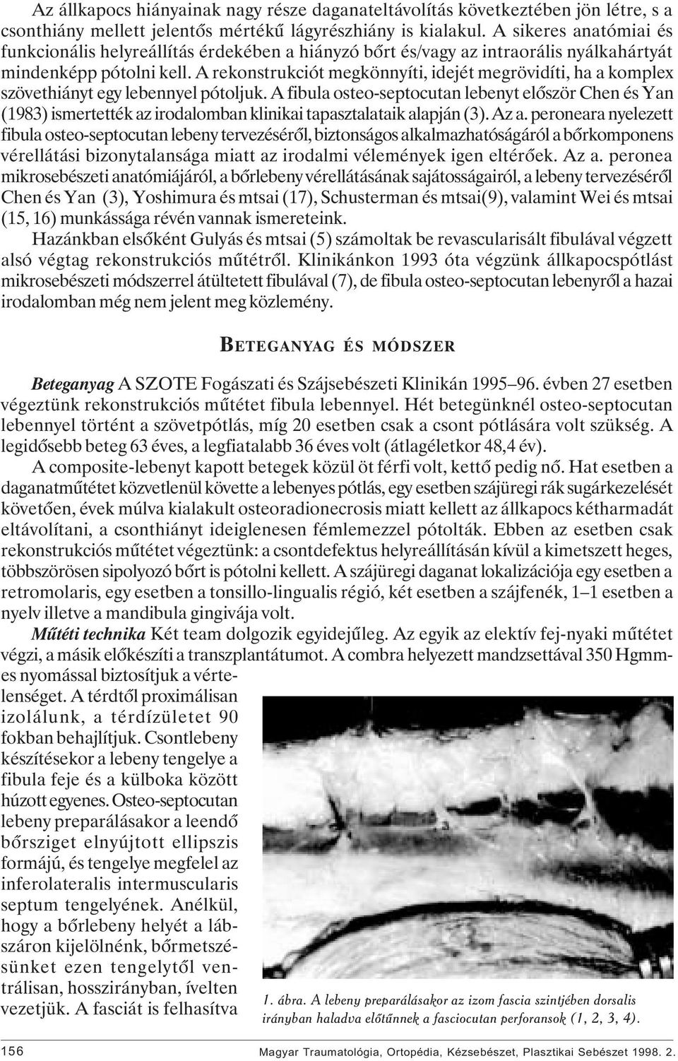 A rekonstrukciót megkönnyíti, idejét megrövidíti, ha a komplex szövethiányt egy lebennyel pótoljuk.