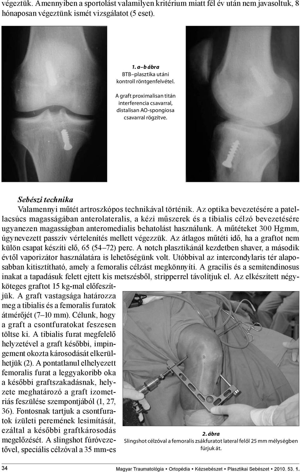 Az optika bevezetésére a patellacsúcs magasságában anterolateralis, a kézi műszerek és a tibialis célzó bevezetésére ugyanezen magasságban anteromedialis behatolást használunk.