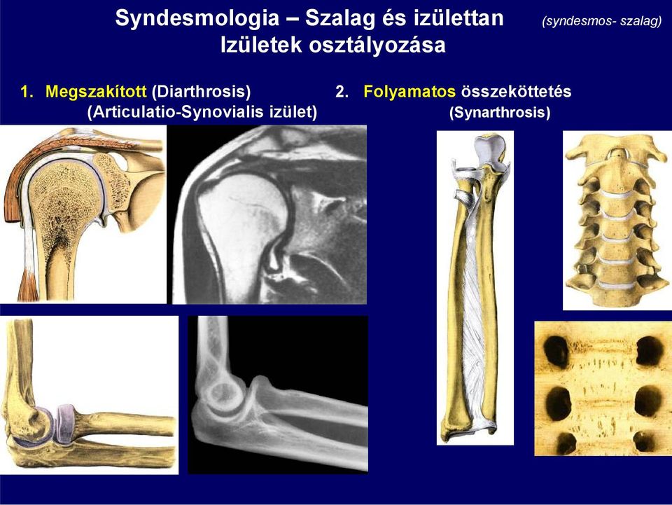 Megszakított (Diarthrosis) 2.