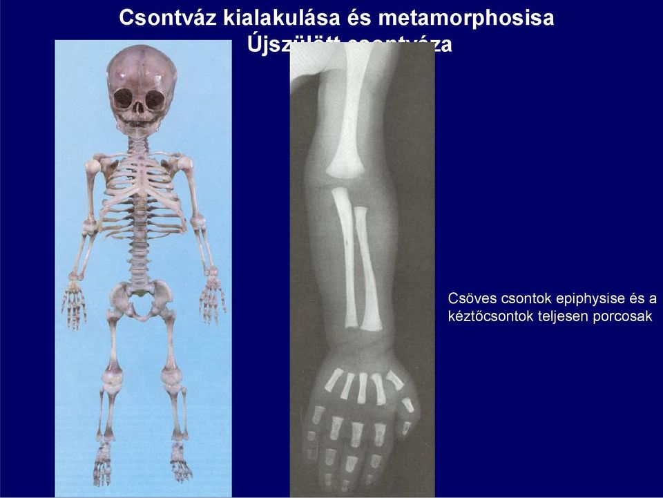 csontváza Csöves csontok