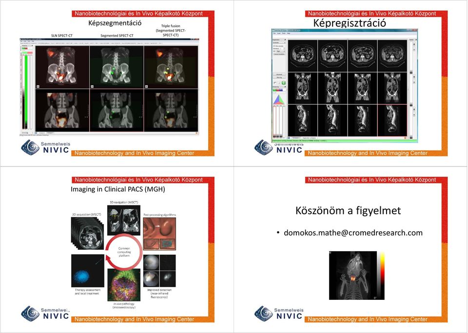 Képregisztráció Imaging in Clinical PACS (MGH)