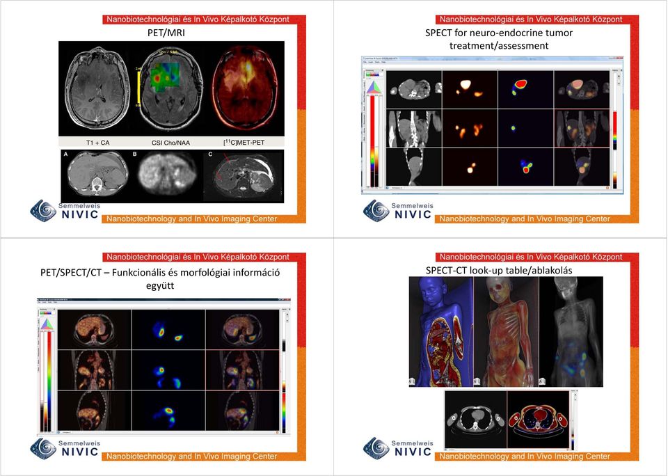 PET/SPECT/CT Funkcionális és