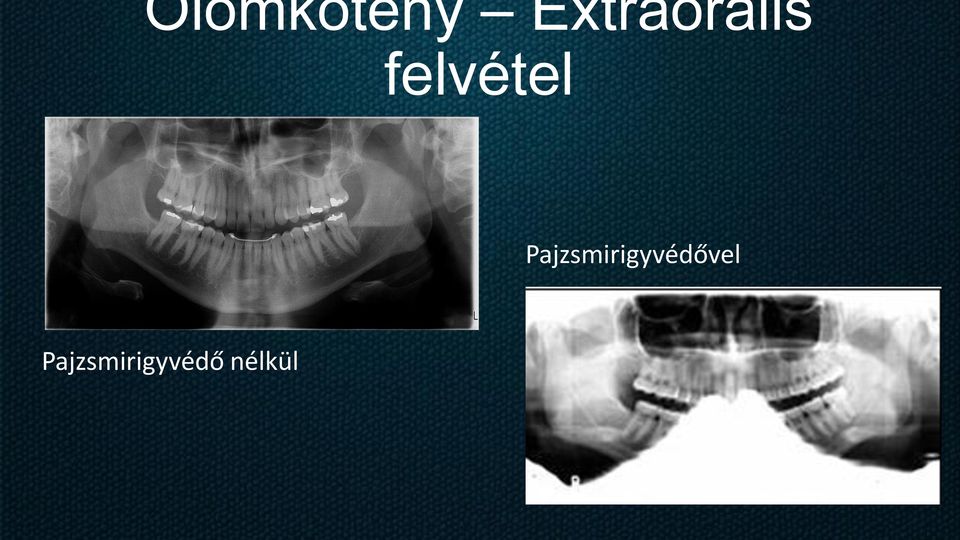 felvétel