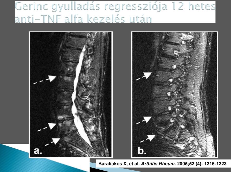 Arthitis Rheum.