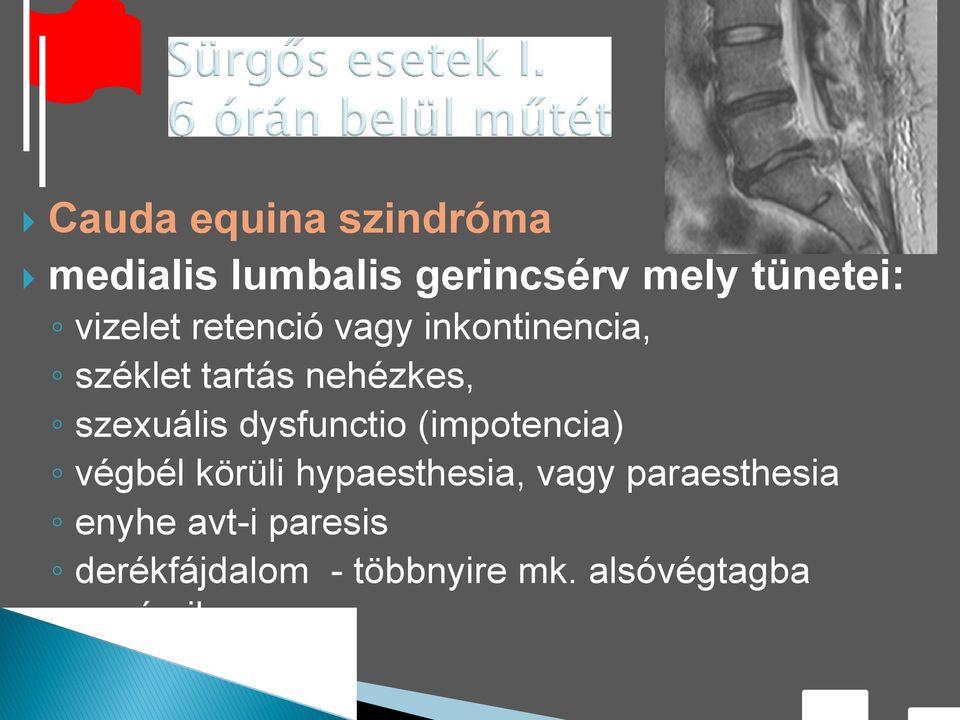 szexuális dysfunctio (impotencia) végbél körüli hypaesthesia, vagy