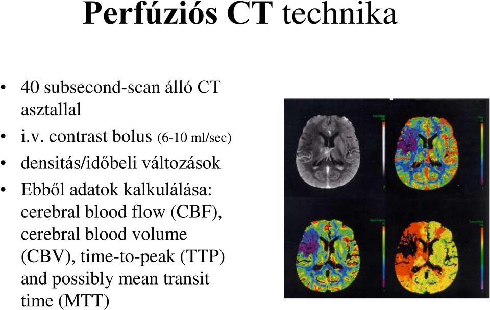 adatok kalkulálása: cerebral blood flow (CBF), cerebral blood