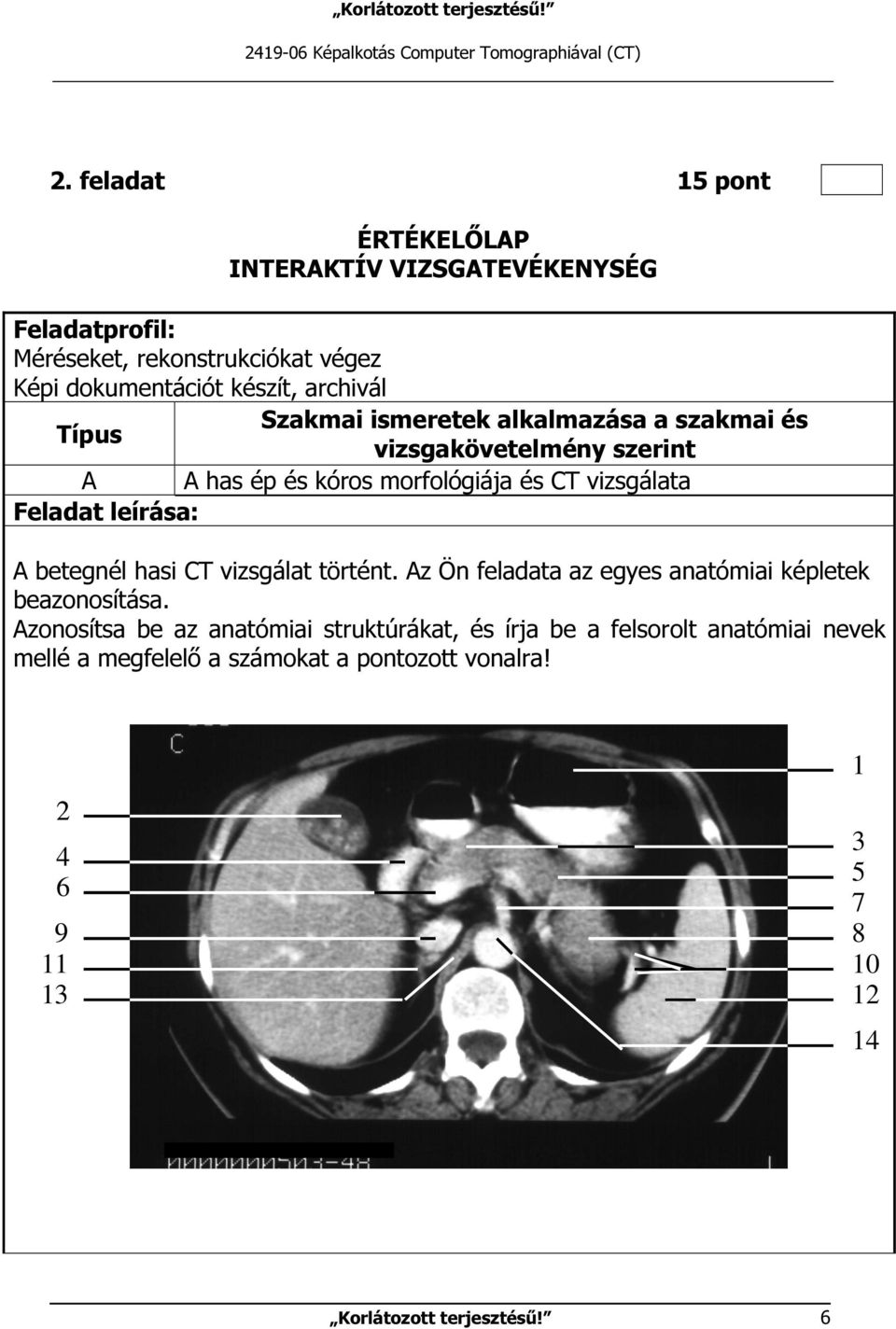 ismeretek alkalmazása a szakmai és Típus vizsgakövetelmény szerint A A has ép és kóros morfológiája és CT vizsgálata Feladat leírása: A betegnél hasi CT