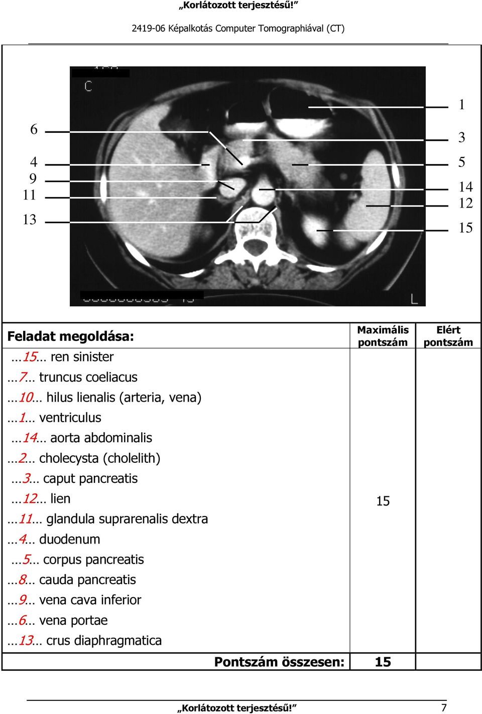 pancreatis 2 lien glandula suprarenalis dextra 4 duodenum 5 corpus pancreatis 8 cauda pancreatis 9 vena cava