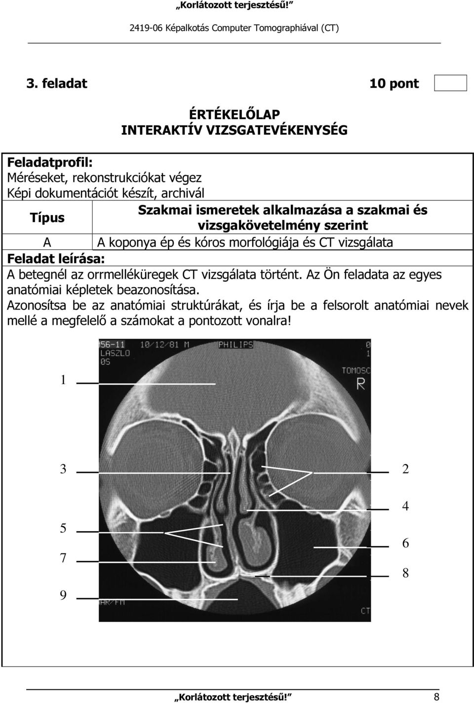 ismeretek alkalmazása a szakmai és Típus vizsgakövetelmény szerint A A koponya ép és kóros morfológiája és CT vizsgálata Feladat leírása: A betegnél az