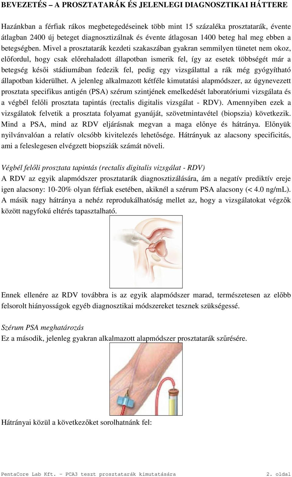 Mivel a prosztatarák kezdeti szakaszában gyakran semmilyen tünetet nem okoz, előfordul, hogy csak előrehaladott állapotban ismerik fel, így az esetek többségét már a betegség késői stádiumában