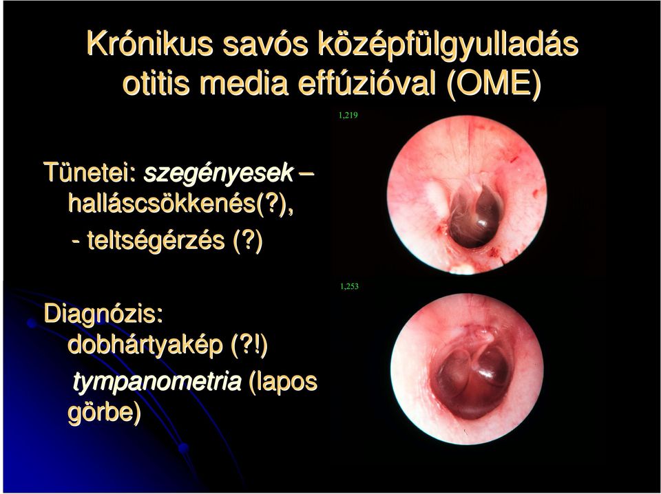 scsökkenés(?), - teltségérz rzés s (?