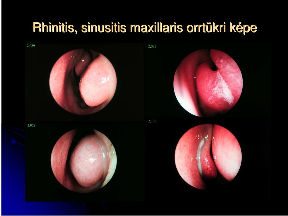 maxillaris