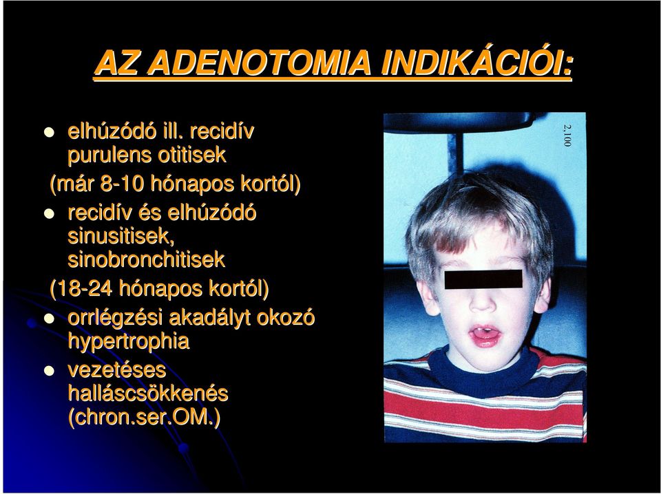 s elhúzódó sinusitisek, sinobronchitisek (18-24 hónapos h kortól)