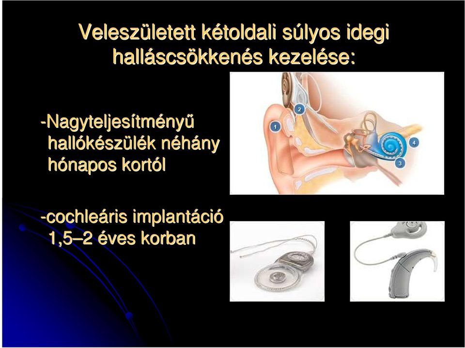 -Nagyteljesítményő hallókész szülék k néhány n