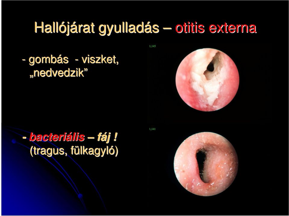 nedvedzik - bacteriális fáj