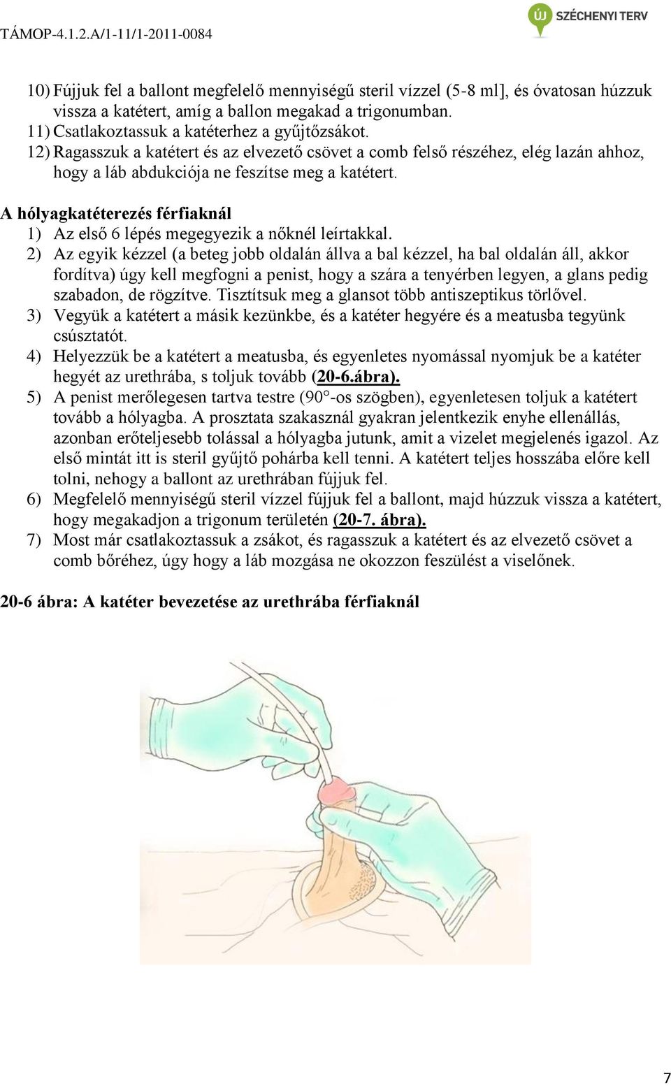 A hólyagkatéterezés férfiaknál 1) Az első 6 lépés megegyezik a nőknél leírtakkal.