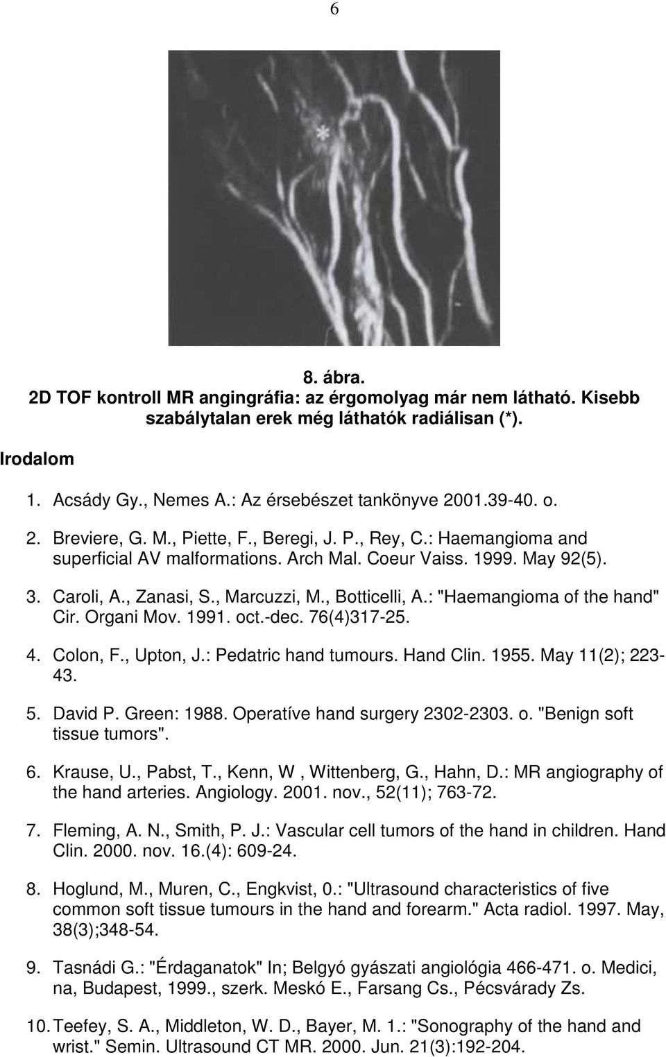 : "Haemangioma of the hand" Cir. Organi Mov. 1991. oct.-dec. 76(4)317-25. 4. Colon, F., Upton, J.: Pedatric hand tumours. Hand Clin. 1955. May 11(2); 223-43. 5. David P. Green: 1988.