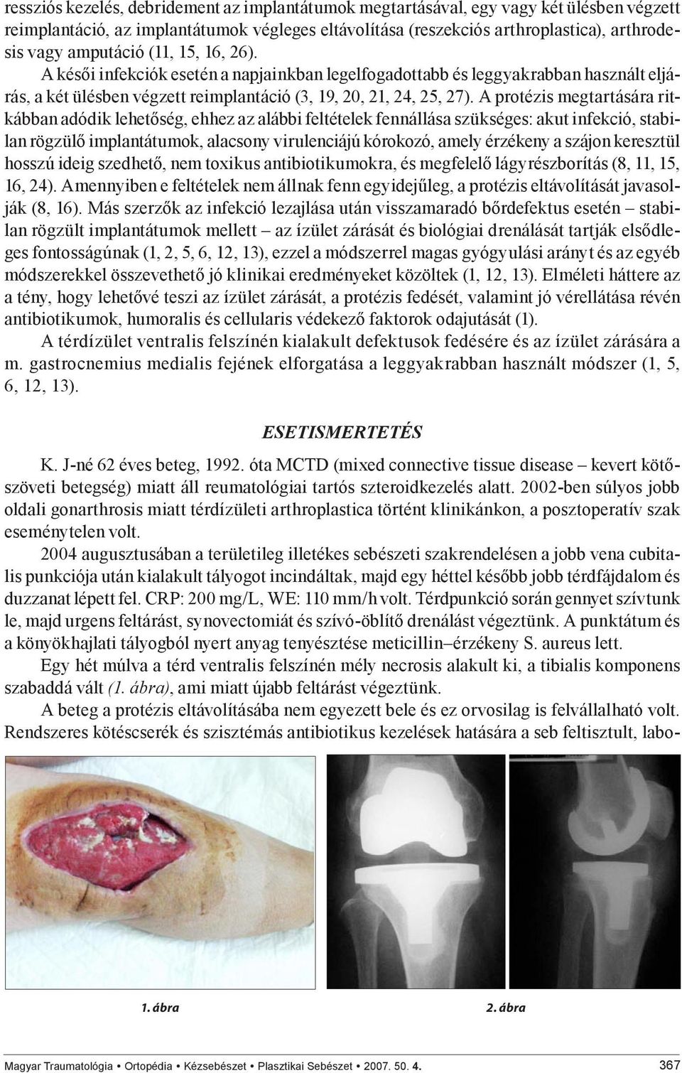 A protézis megtartására ritkábban adódik lehetőség, ehhez az alábbi feltételek fennállása szükséges: akut infekció, stabilan rögzülő implantátumok, alacsony virulenciájú kórokozó, amely érzékeny a
