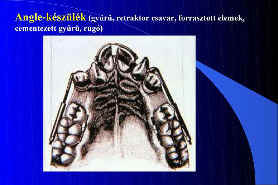 csavar, forrasztott