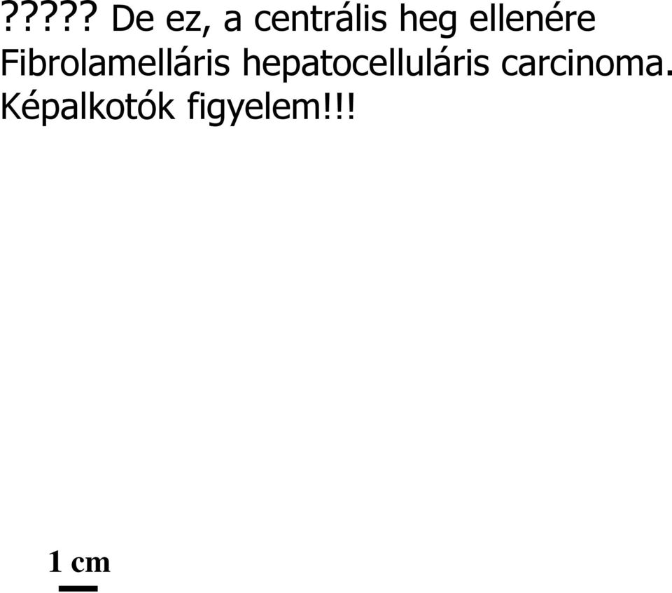 Fibrolamelláris
