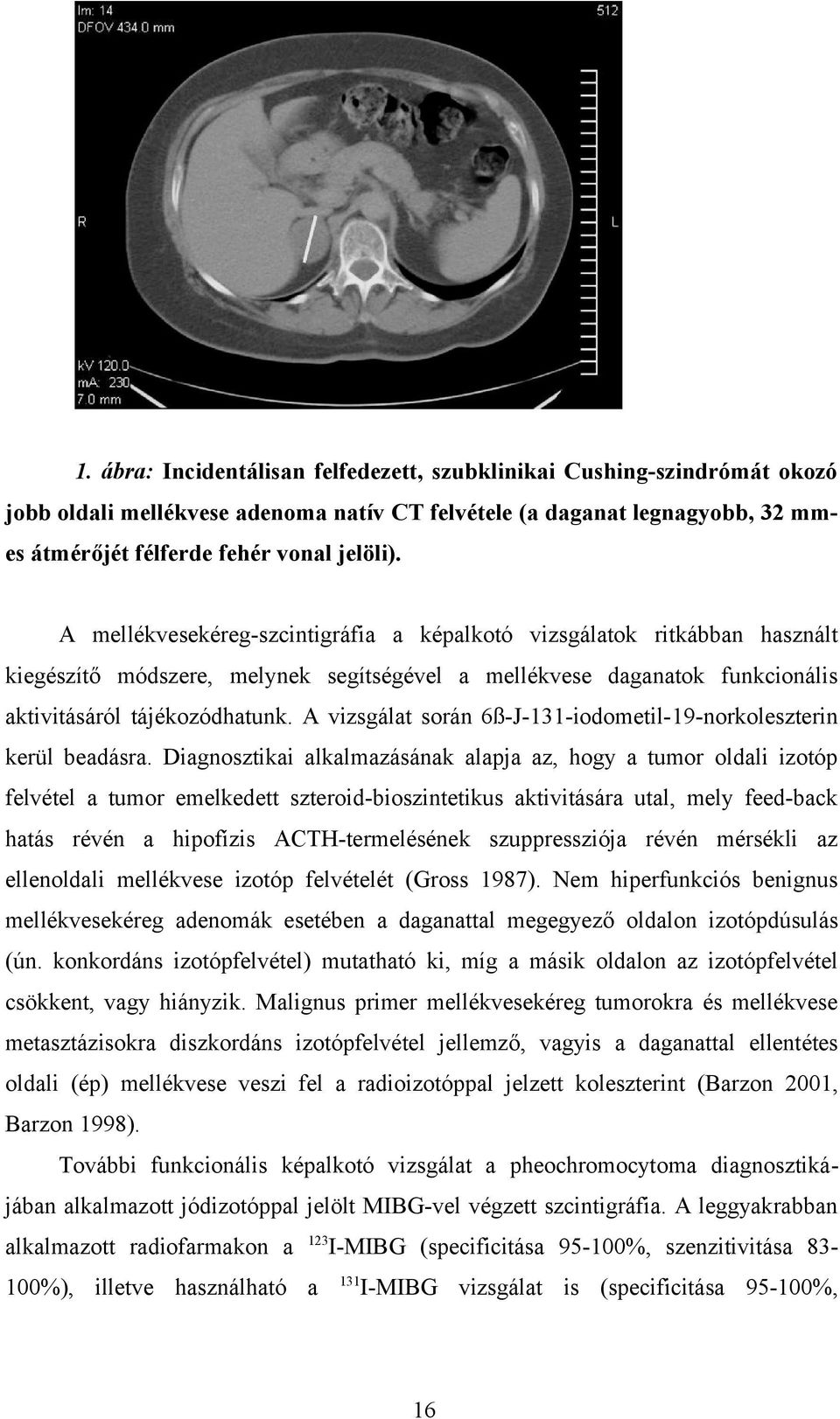 A vizsgálat során 6ß-J-131-iodometil-19-norkoleszterin kerül beadásra.