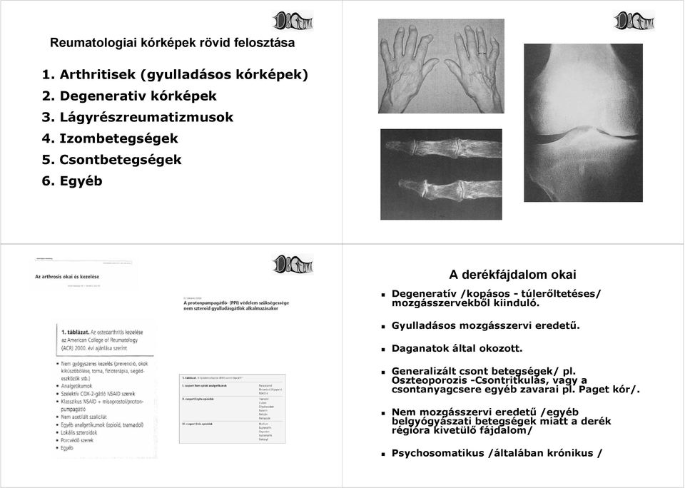 Gyulladásos mozgásszervi eredetű. Daganatok által okozott. Generalizált lt csont betegsé/ / pl.