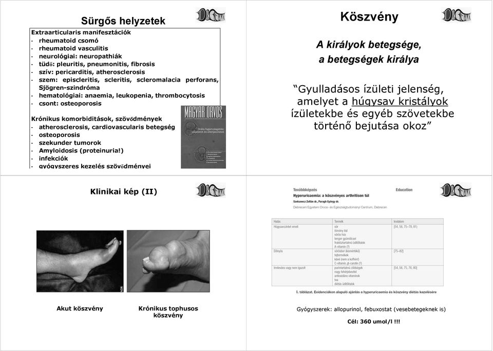 szövődmények - atherosclerosis, cardiovascularis betegség - osteoporosis - szekunder tumorok - Amyloidosis (proteinuria!