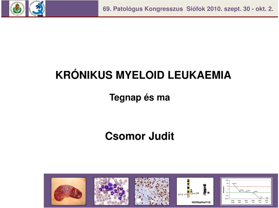 KRÓNIKUS MYELOID LEUKAEMIA Tegnap és ma Csomor Judit 1000 100