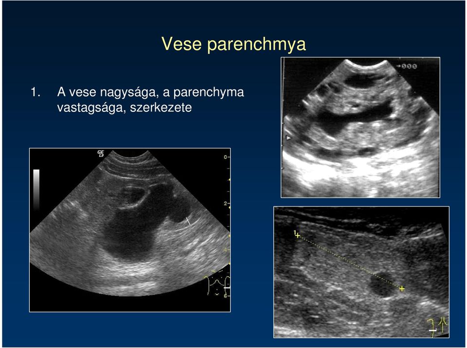 a parenchyma