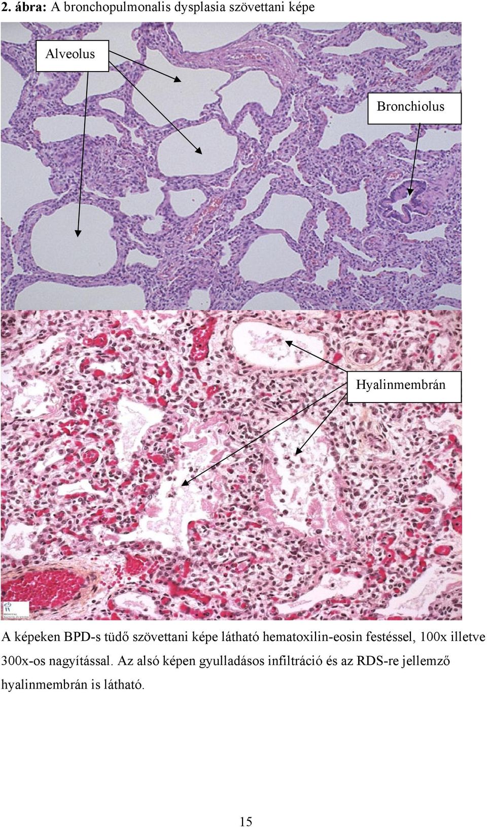 hematoxilin-eosin festéssel, 100x illetve 300x-os nagyítással.