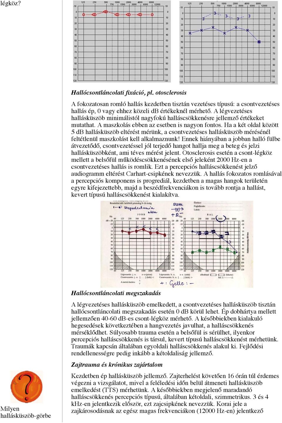 Ha a két oldal között 5 db hallásküszöb eltérést mérünk, a csontvezetéses hallásküszöb mérésénél feltétlenül maszkolást kell alkalmaznunk!
