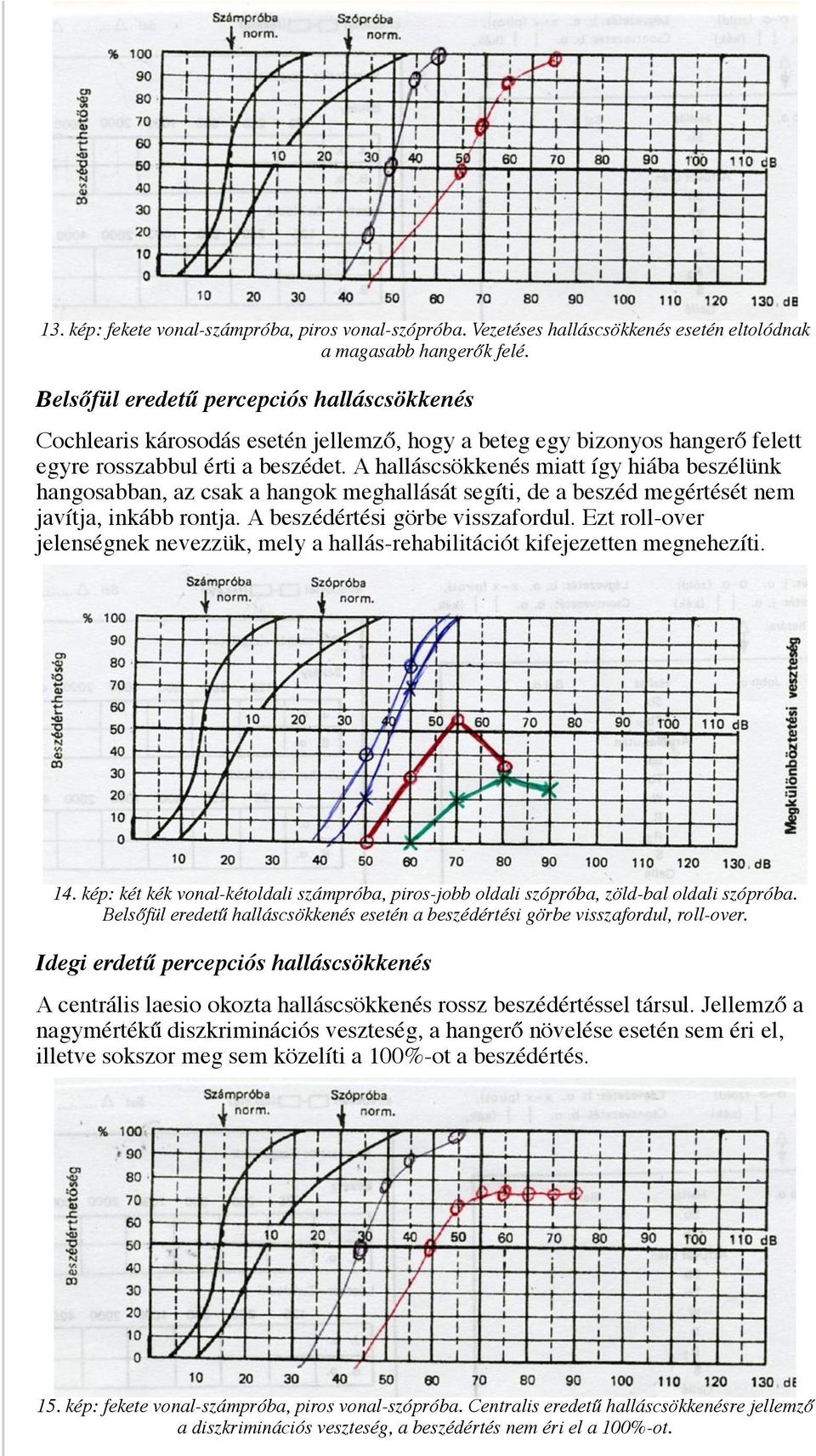 A halláscsökkenés miatt így hiába beszélünk hangosabban, az csak a hangok meghallását segíti, de a beszéd megértését nem javítja, inkább rontja. A beszédértési görbe visszafordul.