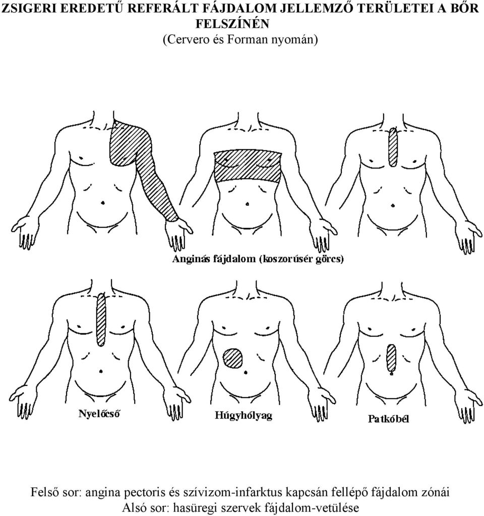 angina pectoris és szívizom-infarktus kapcsán fellépő