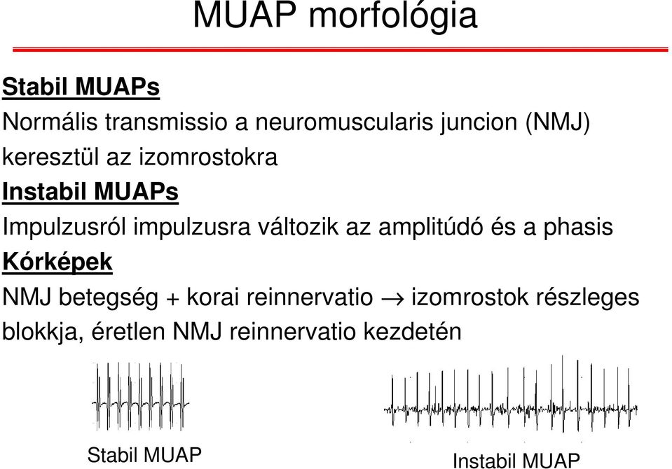 változik az amplitúdó és a phasis Kórképek NMJ betegség + korai reinnervatio